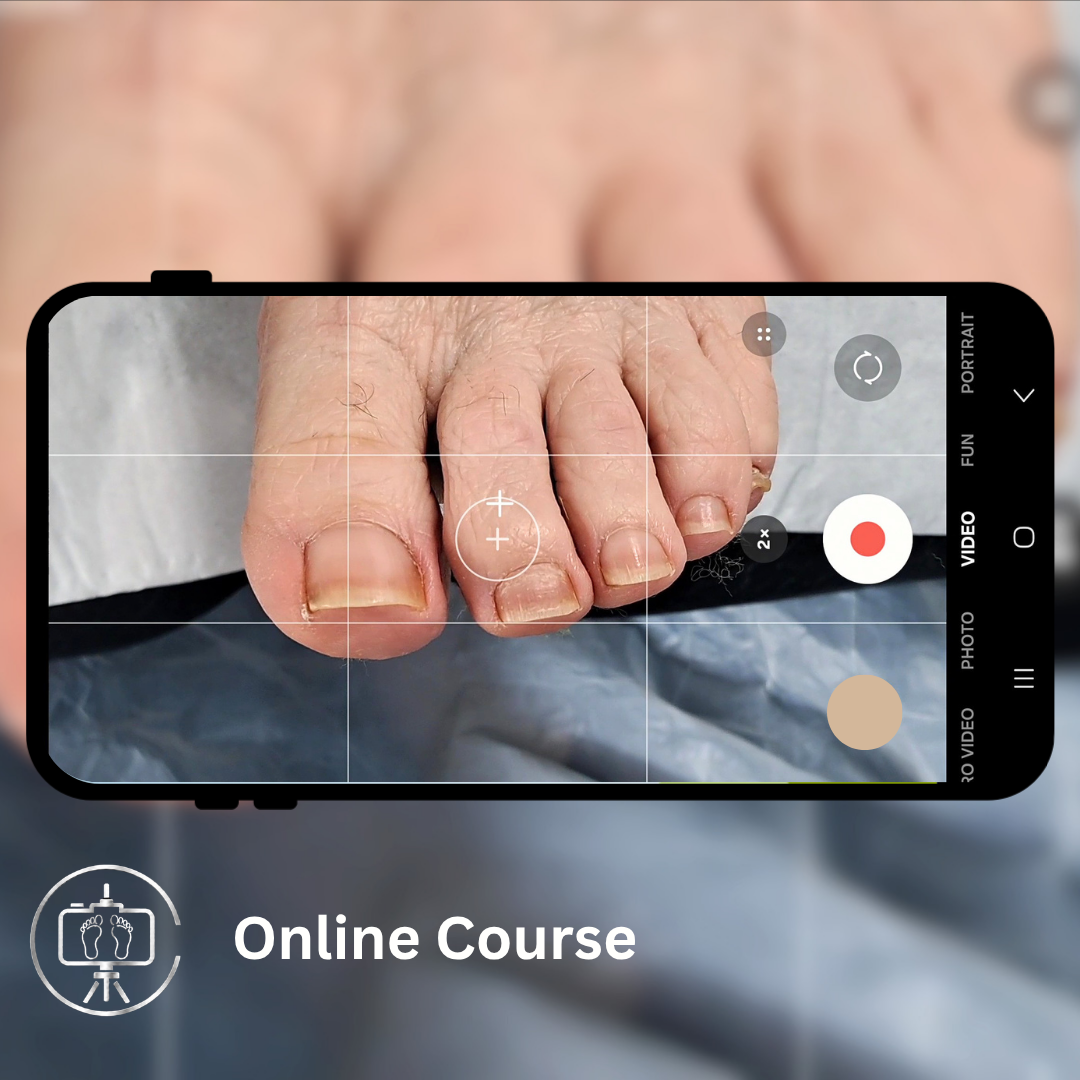Overhead Filming for Foot Care Professionals